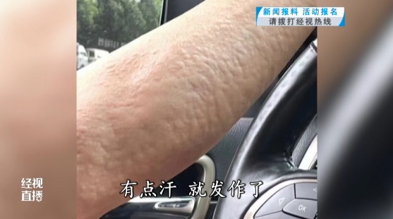 吃面食后运动,武汉一男子猝发昏迷!医生提醒:这类人要注意 吃面食后运动,武汉一男子猝发昏迷!医生提醒:这类人要注意