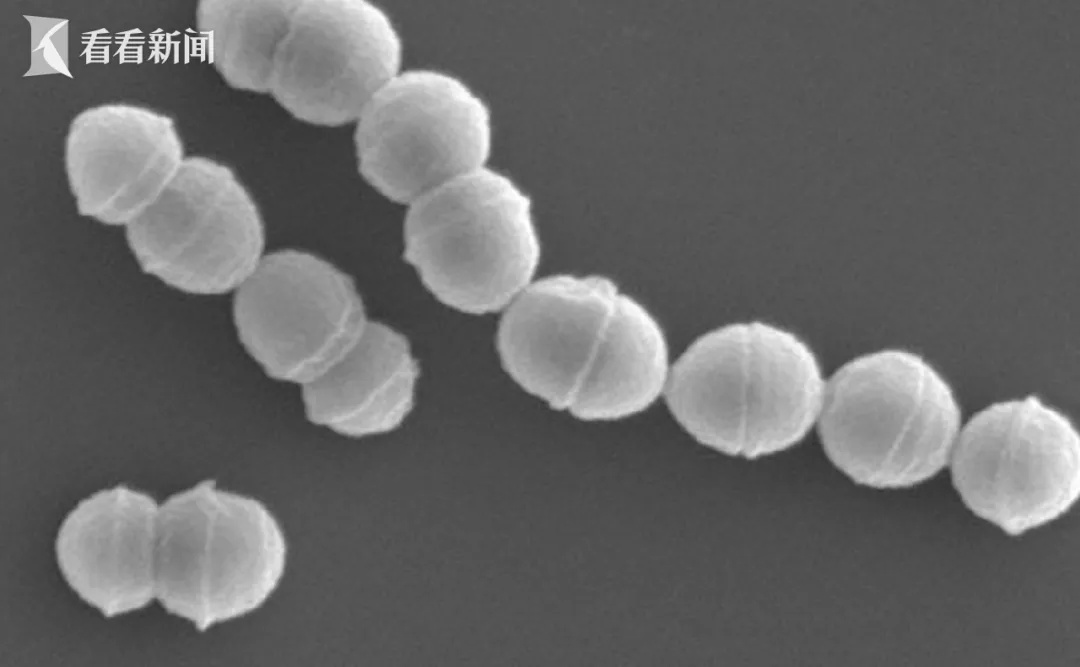 日本疫情持续!超250人死亡,可通过飞沫传染 日本疫情持续!超250人死亡,可通过飞沫传染