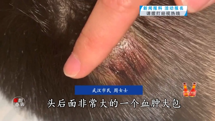 武汉6岁男童超市内滑倒摔伤头！家长：保洁刚用湿拖把拖完地……