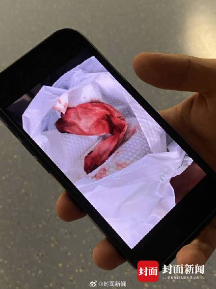 旅客乘机发现置物袋有渗血布条 西部航空：正在调查处理