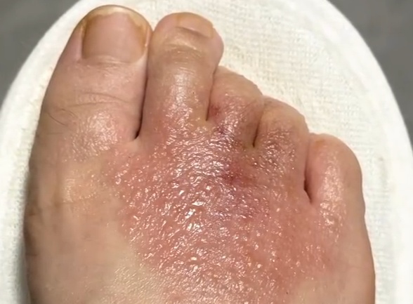 商场试个鞋，脚痒死了，密密麻麻都是……