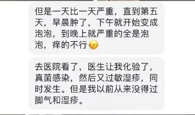女子试完鞋后瘙痒难耐，密密麻麻全是…