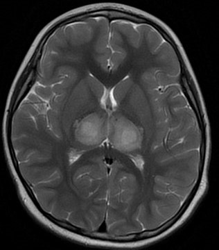 5岁男孩突然发热,送医后抽搐昏迷!上海疾控提醒:高峰即将来临 5岁男孩突然发热,送医后抽搐昏迷!上海疾控提醒:高峰即将来临