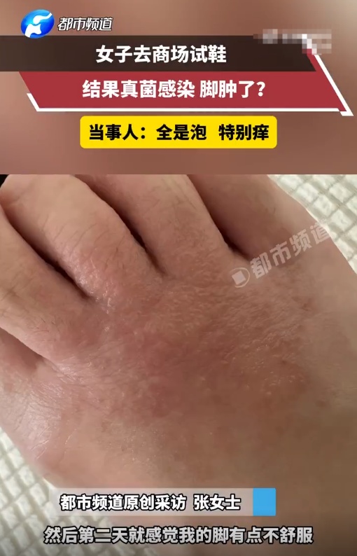 “头皮发麻！”女子试完鞋后瘙痒难耐，很多人有类似经历