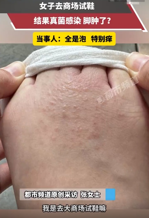 “头皮发麻！”女子试完鞋后瘙痒难耐，很多人有类似经历
