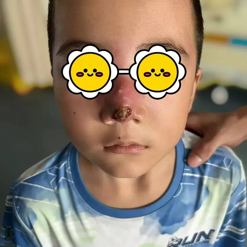 发高烧！7岁男孩确诊 医生：严重可致命