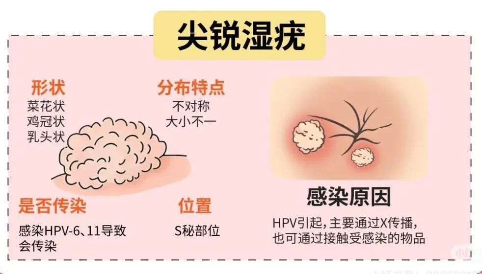 HPV疫苗价格大跳水!什么时候打,怎么打最划算?男女必看! HPV疫苗价格大跳水!什么时候打,怎么打最划算?男女必看!