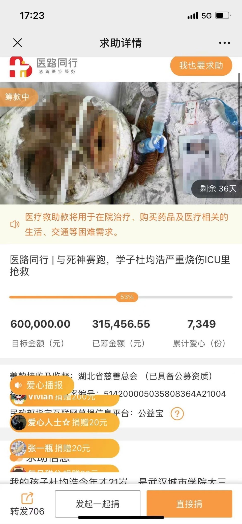 大学生在出租房给电动车电池充电,爆燃致舍友90%以上烧伤,律师分析 大学生在出租房给电动车电池充电,爆燃致舍友90%以上烧伤,律师分析