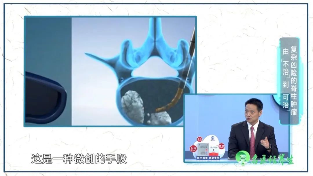 太突然，百万博主因它去世了！平时有腰背疼痛要引起重视