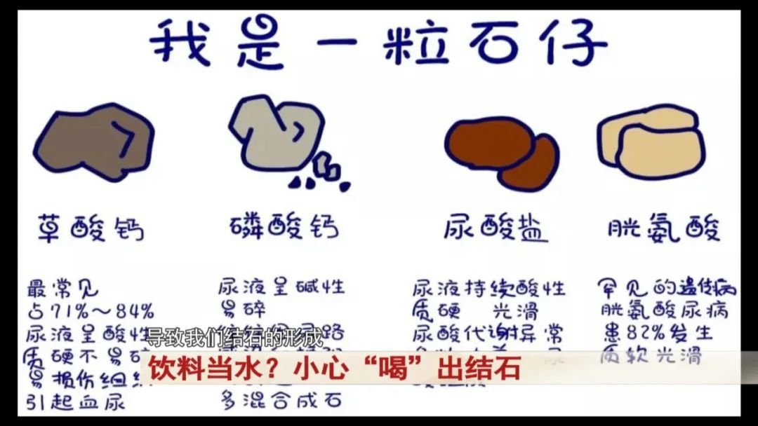 27岁女孩是“重度”饮料爱好者,把饮料当水,腰突然开始疼痛!医生提醒... 27岁女孩是“重度”饮料爱好者,把饮料当水,腰突然开始疼痛!医生提醒...