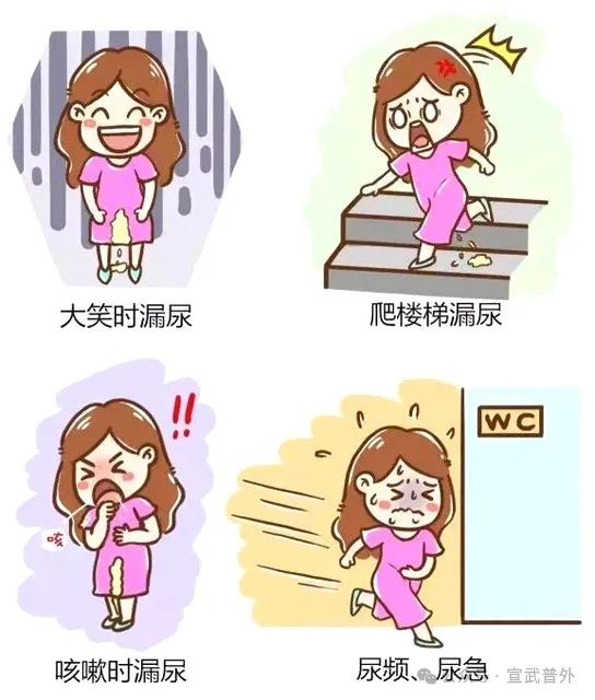 预防尿失禁的发生从日常做起 预防尿失禁的发生从日常做起