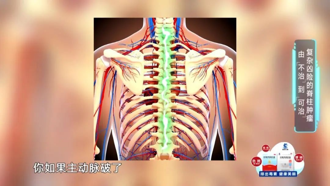 太突然，百万博主因它去世了！平时有腰背疼痛要引起重视