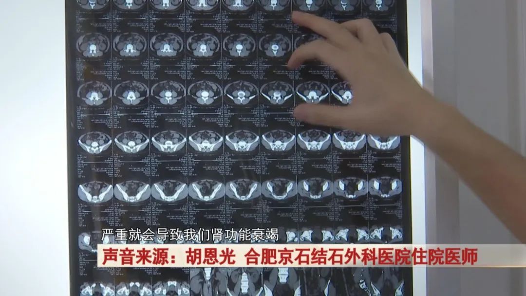 27岁女孩是“重度”饮料爱好者,把饮料当水,腰突然开始疼痛!医生提醒... 27岁女孩是“重度”饮料爱好者,把饮料当水,腰突然开始疼痛!医生提醒...