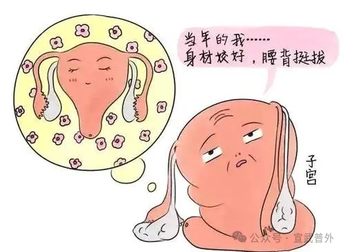 预防尿失禁的发生从日常做起 预防尿失禁的发生从日常做起