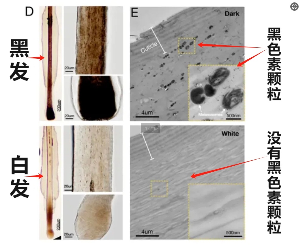 白发拔掉好还是剪掉好？这样做让你变成“花白头”，很多人开始后悔了