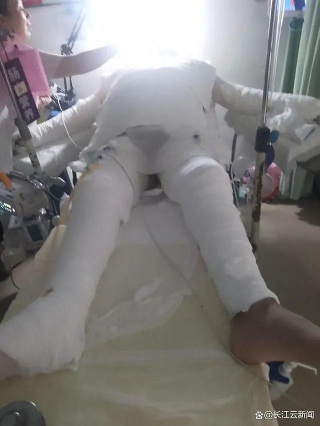 大三学生全身90%烧伤！竟因室友将TA带回屋？