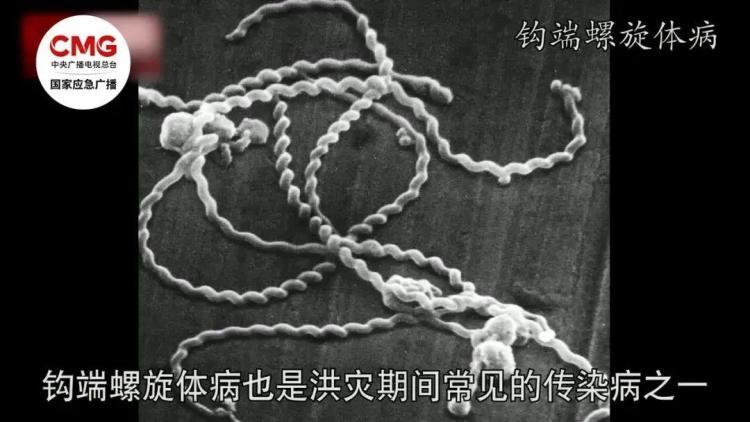 小心水里这个“隐形刺客”！如何避免被钩体病“钩上”？