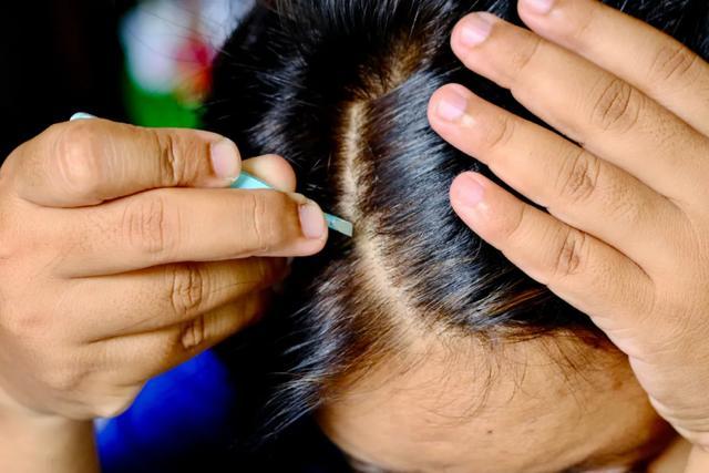 有些白发是晒出来的?晒太阳会让头发变白? 有些白发是晒出来的?晒太阳会让头发变白?