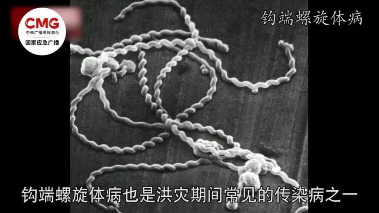 广东一男子因暴雨后赤脚走路住进ICU！医生：致死率达70%