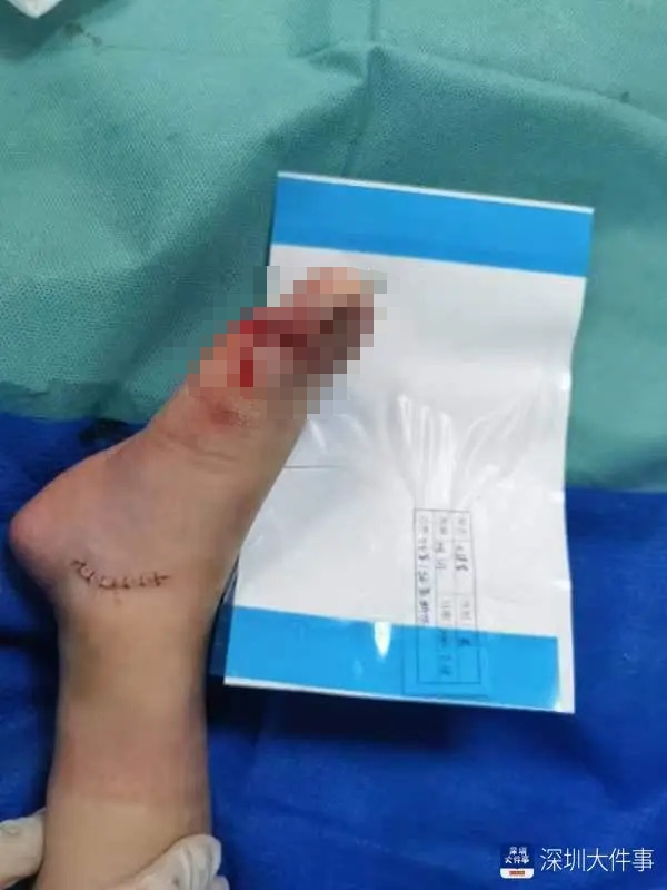 “电梯飞起来，差点吃人”！一商场扶梯，突传巨响