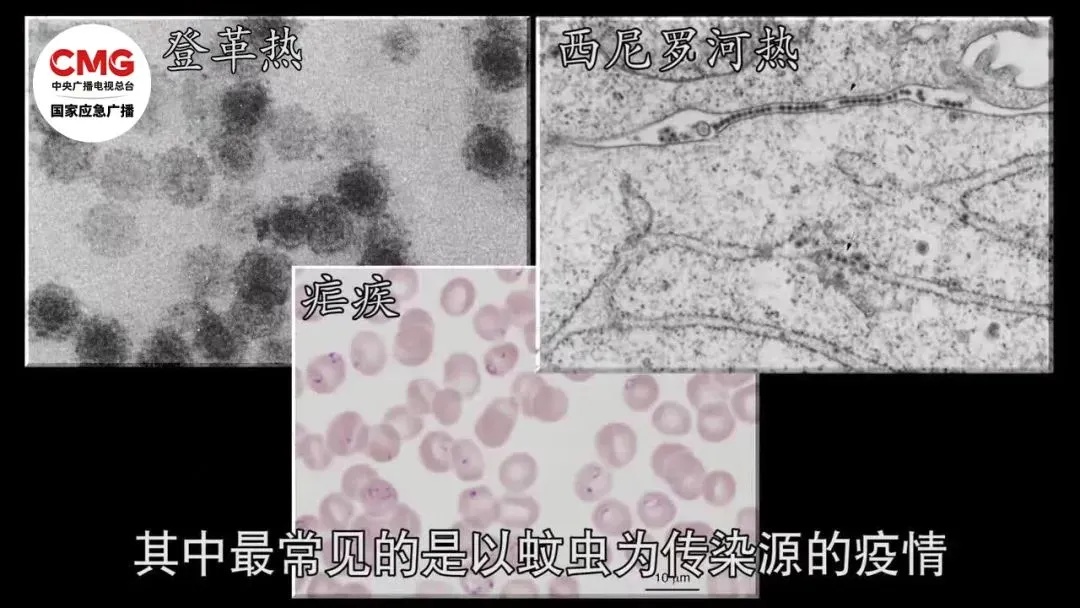 暴雨后赤脚走路，竟让他住进ICU！医生：致死率达70%