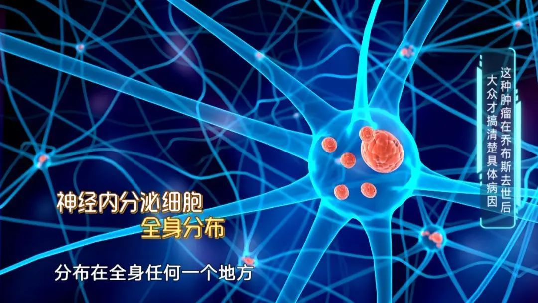 这种肿瘤“千人千面”确诊难，甚至导致了乔布斯的去世！