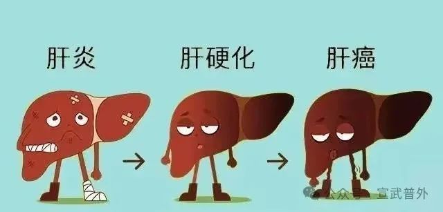 什么是“肝癌三部曲”？
