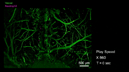 “看穿”大脑！清华团队又又研发一台超级显微镜
