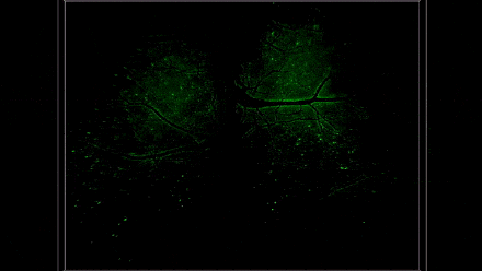 “看穿”大脑！清华团队又又研发一台超级显微镜
