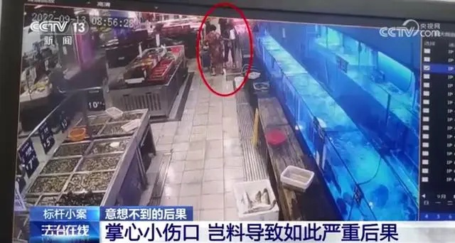 女子超市捞鱼被刺致八级伤残！医生提醒：这些海鲜可能夺命