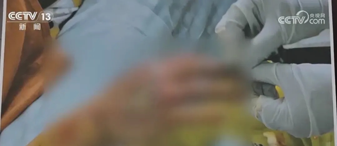 索赔22万！女子超市买鱼被刺八级伤残，法院判了