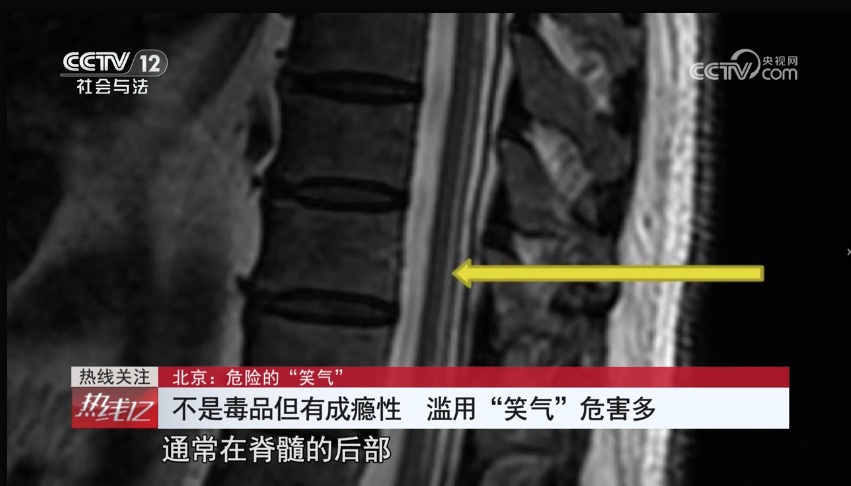 一次成瘾!17岁少女花10万元购买,这种“气体”很危险 一次成瘾!17岁少女花10万元购买,这种“气体”很危险