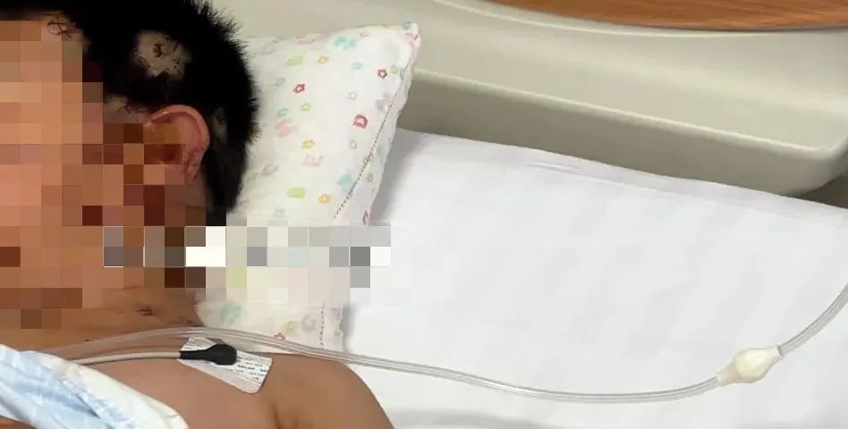 家中“玩具”突然爆炸！8岁男童全脸30多处炸伤，“看不清面貌”！医生提醒......