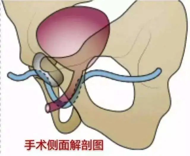 职场社死!36岁女子确诊“尴尬病”! 职场社死!36岁女子确诊“尴尬病”!