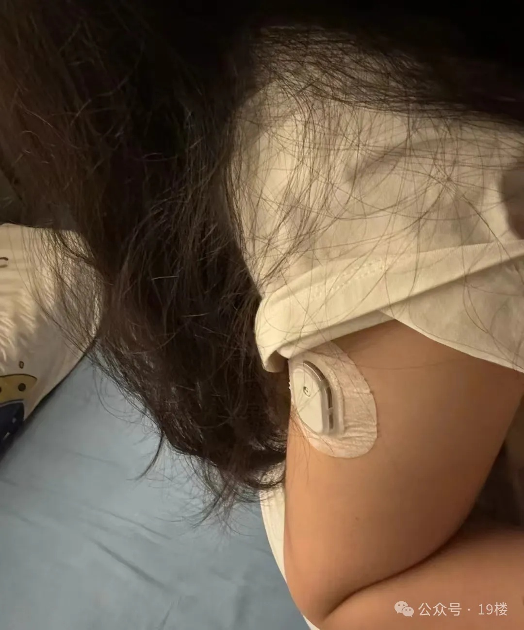 手上扎了200多针，每天吃饭提心吊胆，23岁女生确诊“老年病”……