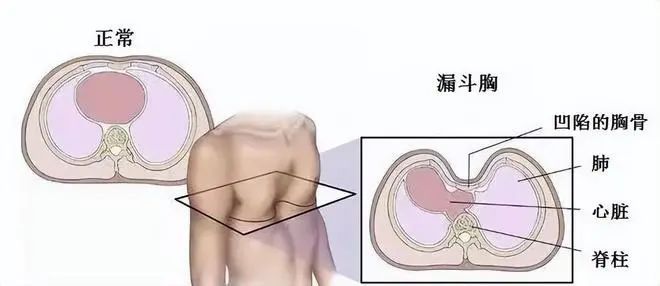 台州14岁男孩确诊！