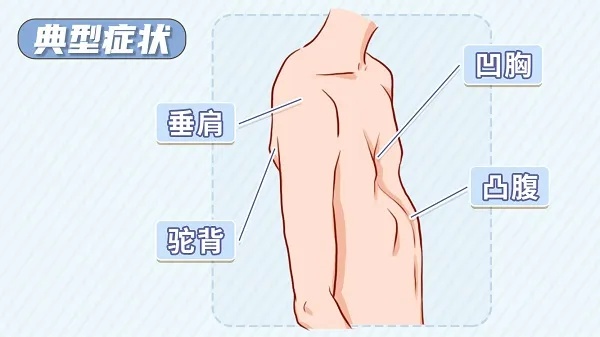 台州14岁男孩确诊！