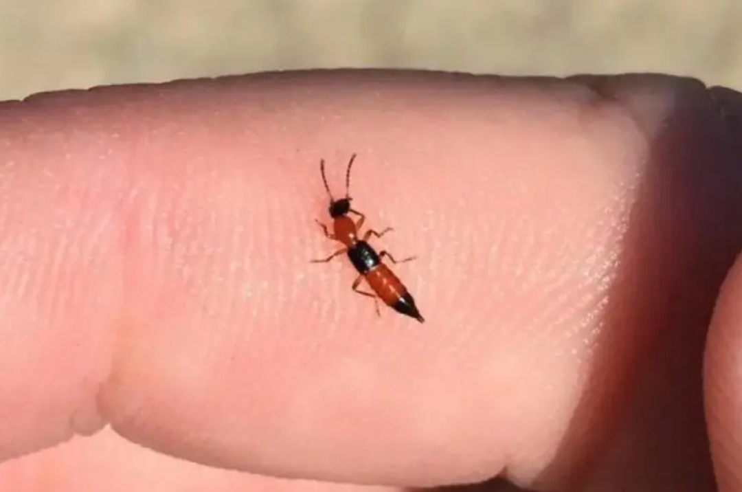 天津出现隐翅虫!毒液堪比硫酸!千万不能用手拍! 天津出现隐翅虫!毒液堪比硫酸!千万不能用手拍!