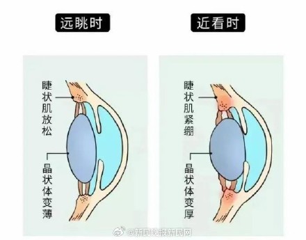 已发生2起！用筋膜枪“按摩”眼睛，视力仅剩0.1