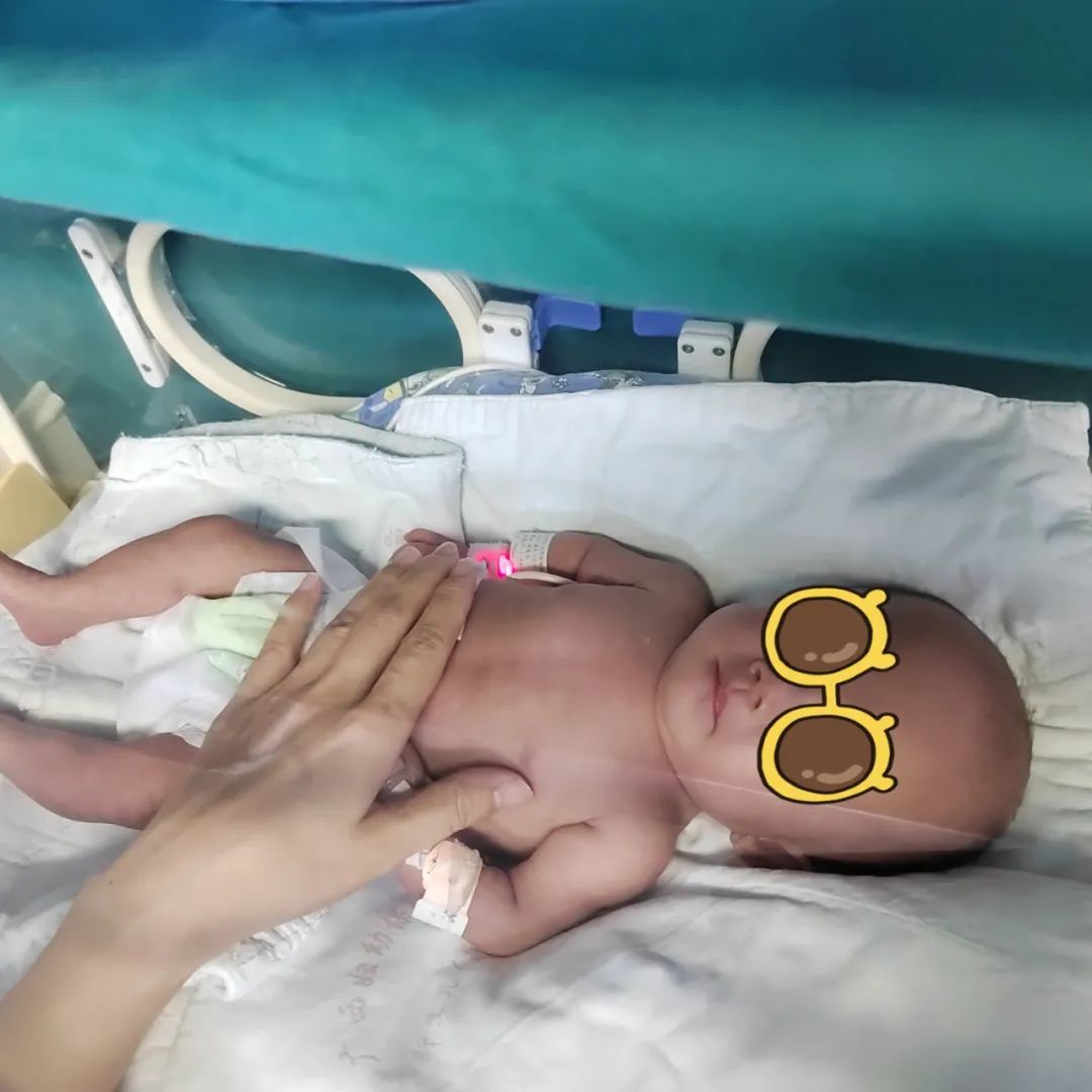 揪心!广西48岁产妇生下“巴掌宝宝”,体重仅430克…… 揪心!广西48岁产妇生下“巴掌宝宝”,体重仅430克……