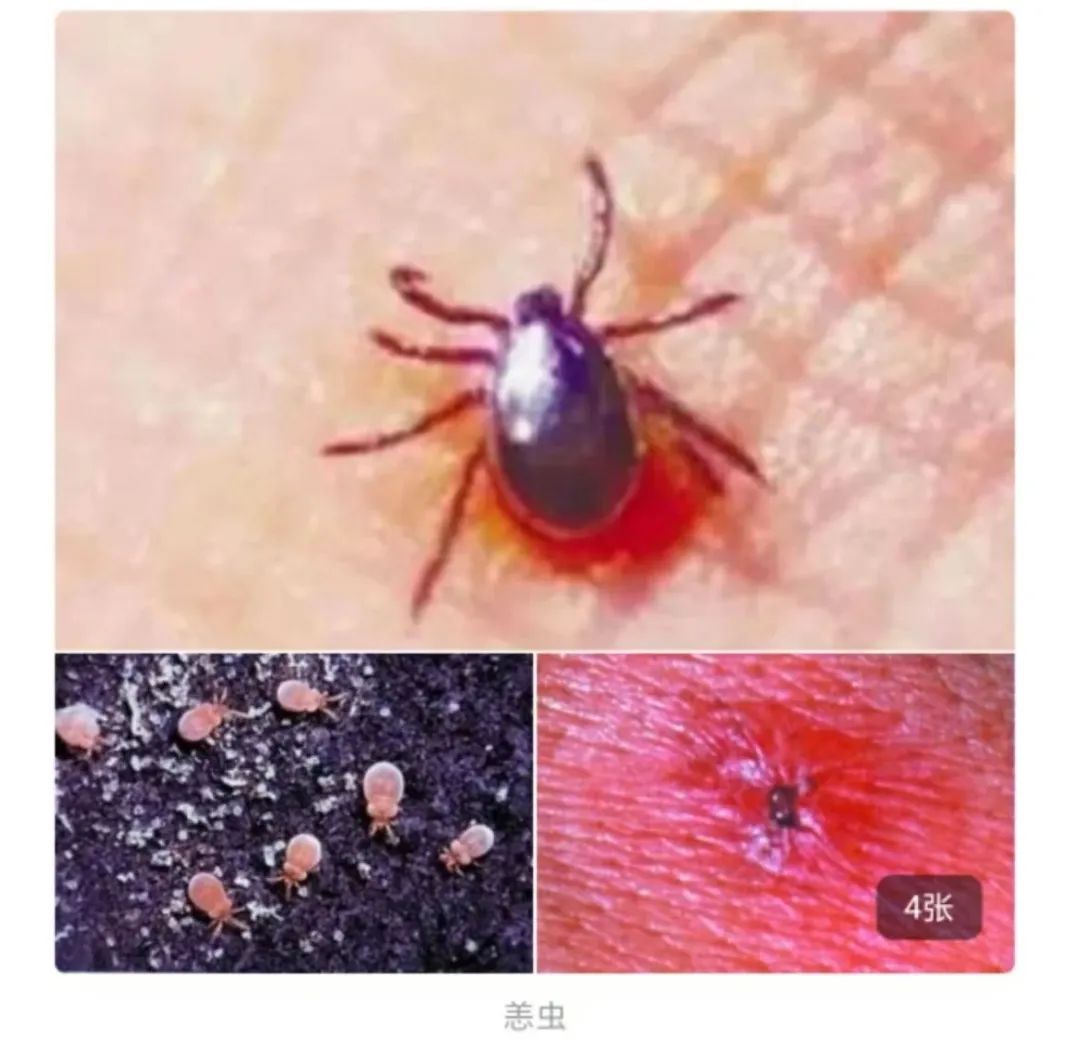 杭州男子被小虫叮咬，只因妻子一个动作，高烧不退！老鼠竟是最主要传播宿主……