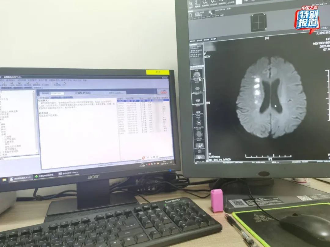 多名患者CT影像几乎一样?医生实名举报:医院涉嫌骗保!官方通报 多名患者CT影像几乎一样?医生实名举报:医院涉嫌骗保!官方通报