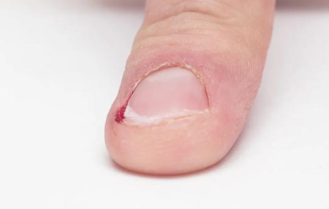 受伤就贴创可贴？这几种情况千万不要，不仅没用还可能...