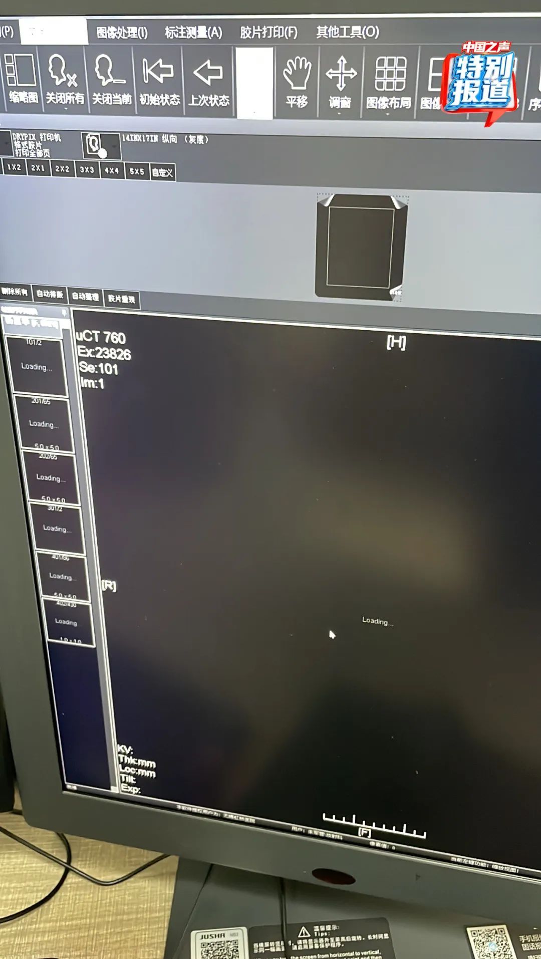 多名患者CT影像几乎一样?医生实名举报:医院涉嫌骗保!官方通报 多名患者CT影像几乎一样?医生实名举报:医院涉嫌骗保!官方通报