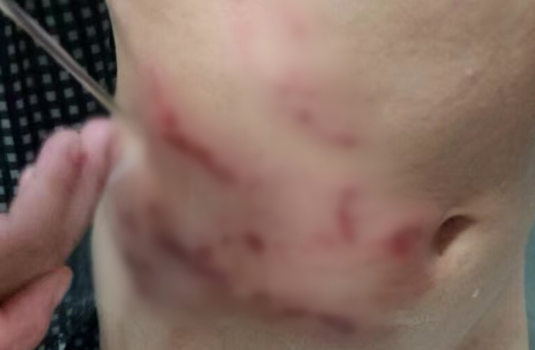 一恶犬扑咬幼童,狗主人已找到 一恶犬扑咬幼童,狗主人已找到