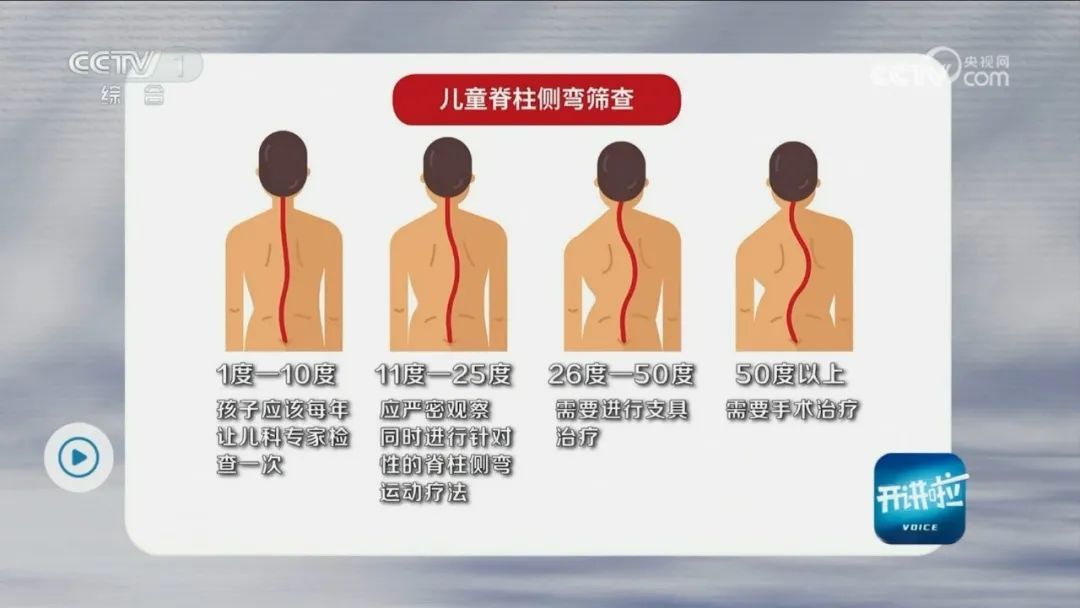 注意！这些疾病可能都与脊柱有关，3招教你来自测！