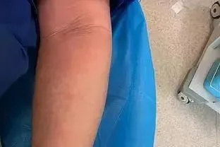 黑龙江已出现！有人休克被抢救！近期高发，千万别碰！