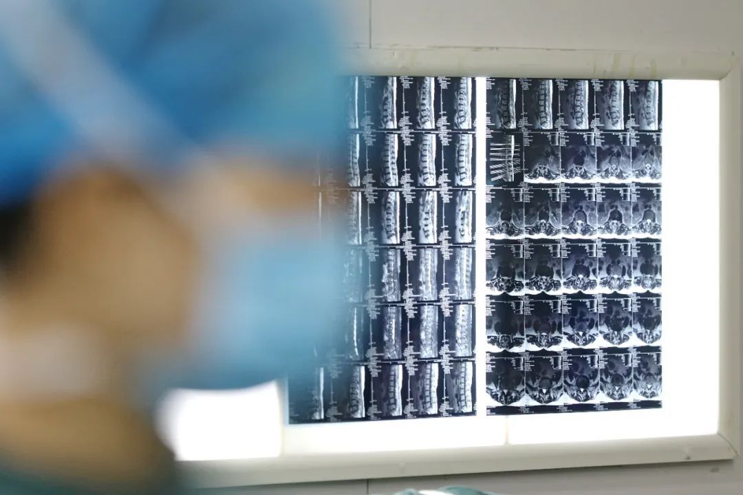 从炎症到癌症只有两三步！给身体“抗炎”，做好这3点！