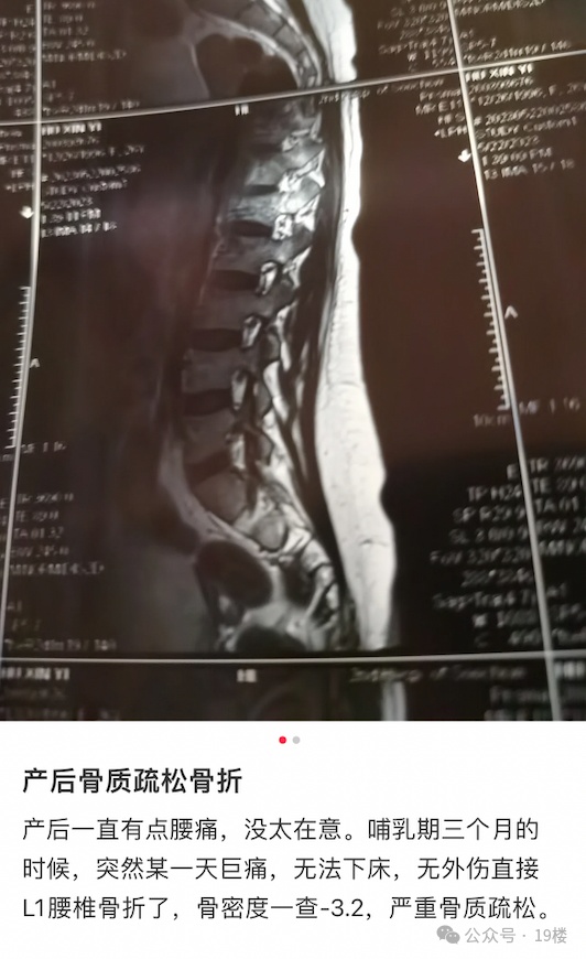 毫无征兆,突然发生!姑娘崩溃,“我怎么会得这个病” 毫无征兆,突然发生!姑娘崩溃,“我怎么会得这个病”