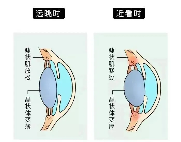 视力暴跌至0.1！这款“神器”很多人家里有，医生提醒→